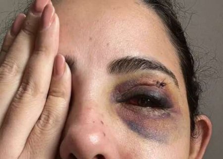 &ldquo;Quis acabar comigo&rdquo;: mulher denuncia ex por espancamento, estupro e c&aacute;rcere