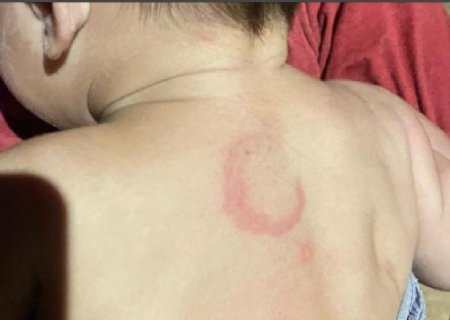 Preso por espancar beb&ecirc; j&aacute; havia sido detido por agredir companheira gr&aacute;vida